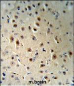 AGO1 Antibody in Immunohistochemistry (Paraffin) (IHC (P))