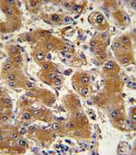 COL6A1 Antibody in Immunohistochemistry (Paraffin) (IHC (P))