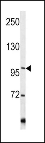 COL6A1 Antibody in Western Blot (WB)