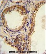 CREB3L1 Antibody in Immunohistochemistry (Paraffin) (IHC (P))