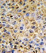 Decorin Antibody in Immunohistochemistry (Paraffin) (IHC (P))