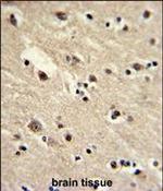 EEF1A1 Antibody in Immunohistochemistry (Paraffin) (IHC (P))