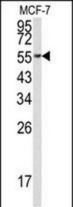 EEF1A1 Antibody in Western Blot (WB)