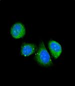 Asporin Antibody in Immunocytochemistry (ICC/IF)