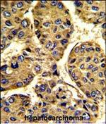 Asporin Antibody in Immunohistochemistry (Paraffin) (IHC (P))