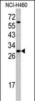 SRSF5 Antibody in Western Blot (WB)