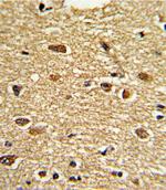 ETV4 Antibody in Immunohistochemistry (Paraffin) (IHC (P))