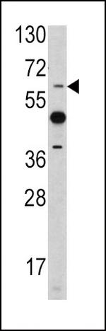 ETV4 Antibody in Western Blot (WB)