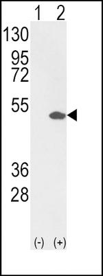 ETV4 Antibody in Western Blot (WB)