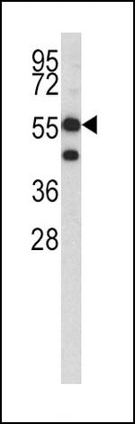 HMGCS1 Antibody in Western Blot (WB)