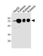 Hemopexin Antibody in Western Blot (WB)