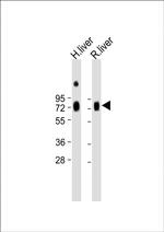 Hemopexin Antibody in Western Blot (WB)