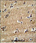 RAB13 Antibody in Immunohistochemistry (Paraffin) (IHC (P))