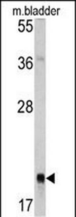 RAB13 Antibody in Western Blot (WB)