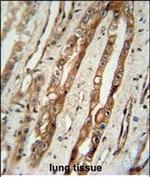 C1 inhibitor Antibody in Immunohistochemistry (Paraffin) (IHC (P))