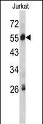 C1 inhibitor Antibody in Western Blot (WB)