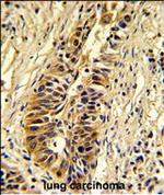 TALDO1 Antibody in Immunohistochemistry (Paraffin) (IHC (P))