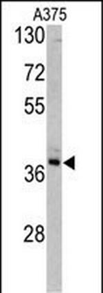 TALDO1 Antibody in Western Blot (WB)