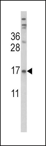 Transthyretin Antibody in Western Blot (WB)