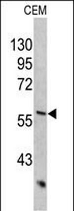 Cytokeratin 10 Antibody in Western Blot (WB)