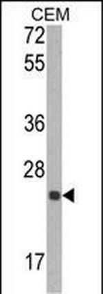 TIMP1 Antibody in Western Blot (WB)