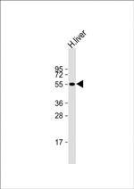 CYP2C19 Antibody in Western Blot (WB)