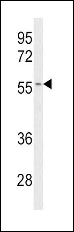 CYP2C19 Antibody in Western Blot (WB)