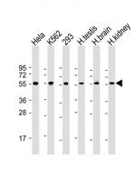 PRAME Antibody in Western Blot (WB)