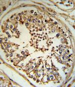 INHA Antibody in Immunohistochemistry (Paraffin) (IHC (P))