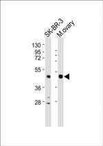 INHA Antibody in Western Blot (WB)