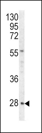 HPRT1 Antibody in Western Blot (WB)