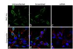 PKC mu Antibody in Immunocytochemistry (ICC/IF)