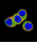 AKT2 Antibody in Immunocytochemistry (ICC/IF)