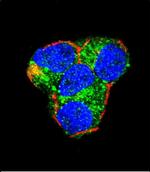 AKT2 Antibody in Immunocytochemistry (ICC/IF)