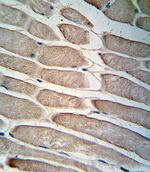 PDK4 Antibody in Immunohistochemistry (Paraffin) (IHC (P))