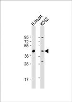 PDK4 Antibody in Western Blot (WB)