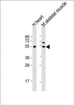 PDK4 Antibody in Western Blot (WB)