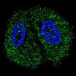 PKM2 Antibody in Immunocytochemistry (ICC/IF)