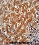 PKM2 Antibody in Immunohistochemistry (Paraffin) (IHC (P))