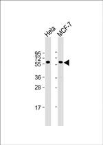 PKM2 Antibody in Western Blot (WB)