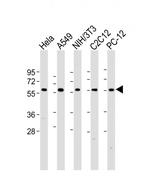 PKM2 Antibody in Western Blot (WB)