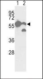 PKM2 Antibody in Western Blot (WB)