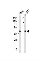 PGK1 Antibody in Western Blot (WB)