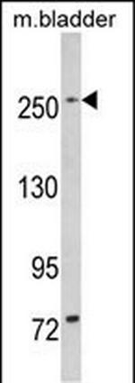 LRRK1 Antibody in Western Blot (WB)