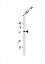 ACVR2A Antibody in Western Blot (WB)