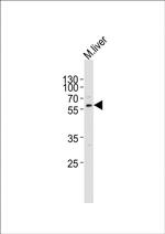 ACVR2A Antibody in Western Blot (WB)