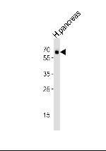 ACVR2B Antibody in Western Blot (WB)