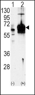 GUCY1A3 Antibody in Western Blot (WB)