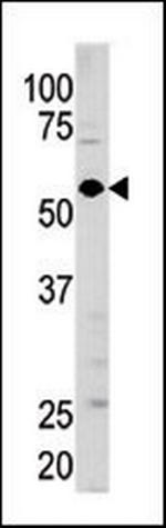 GUCY1A3 Antibody in Western Blot (WB)