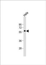 MKNK2 Antibody in Western Blot (WB)